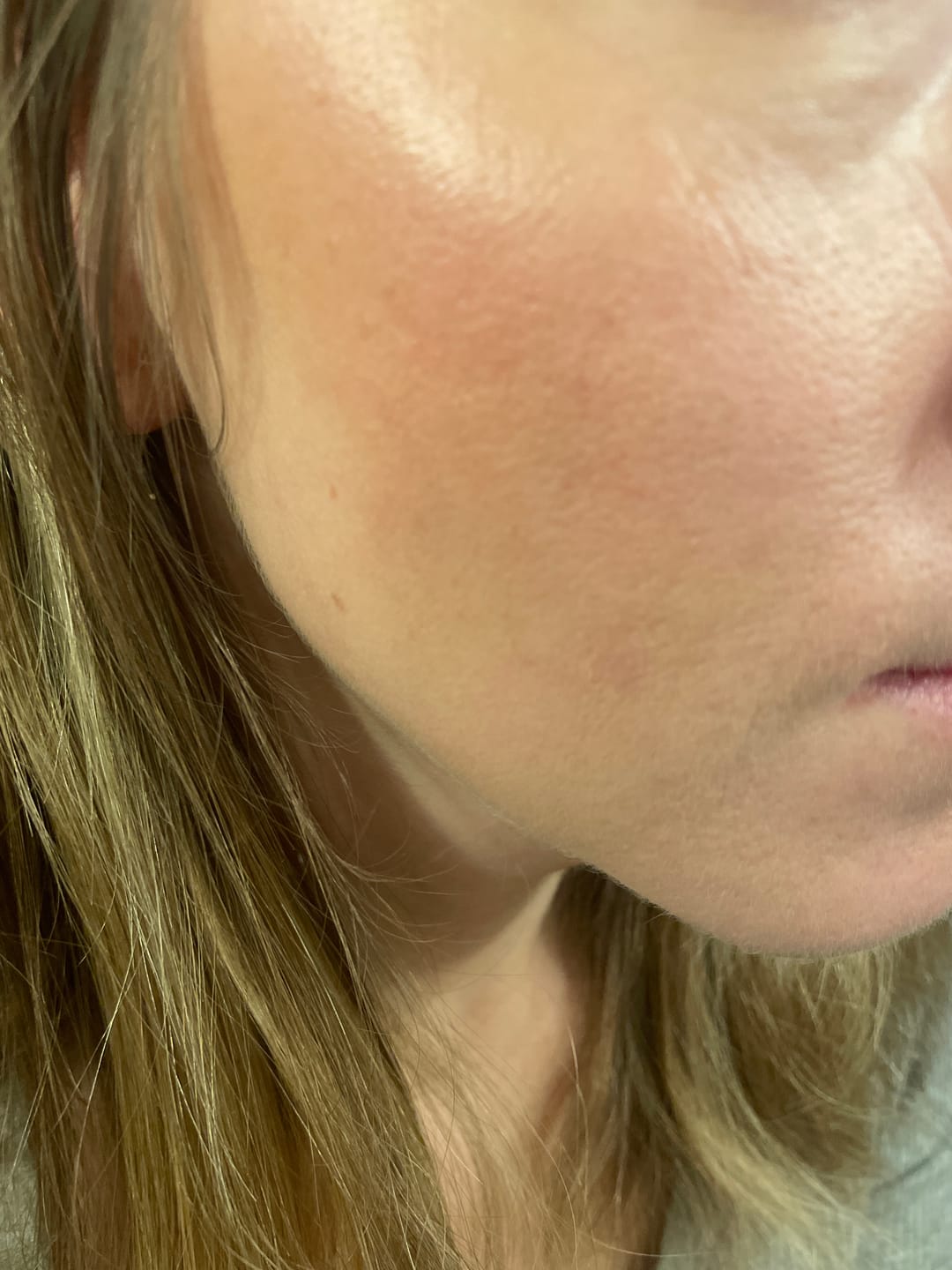 Customer photo review of The Potions Retinol Serum (30ml) - Få økt kollagenproduksjon, jevnere hudtone og mindre akner og porer