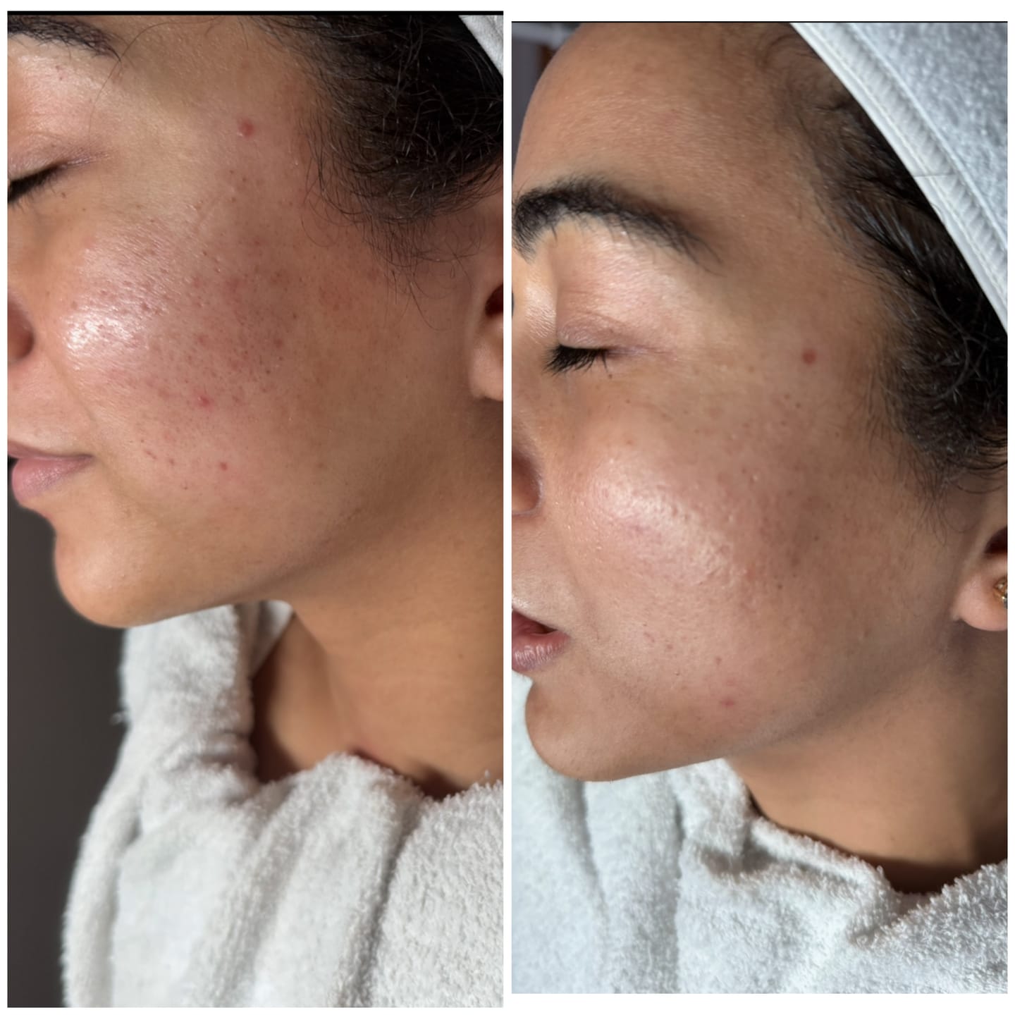 Customer photo review of Zena 100% Organic Algae Peel