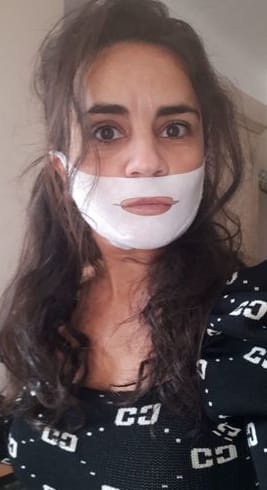 Customer photo review of Blinqo Chinology Sculpt V-Lift Mask