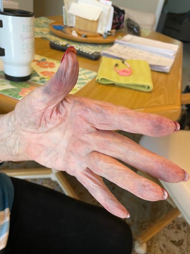 Customer photo review of Swivel Shower Chair Transfer Bench