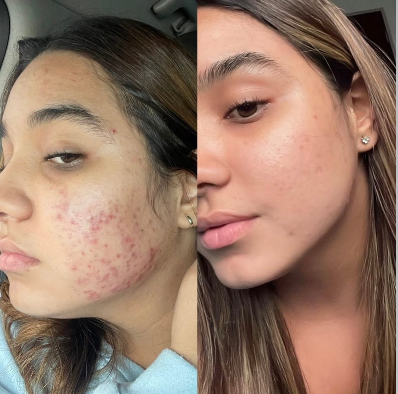Customer photo review of Zena 100% Organic Algae Peel