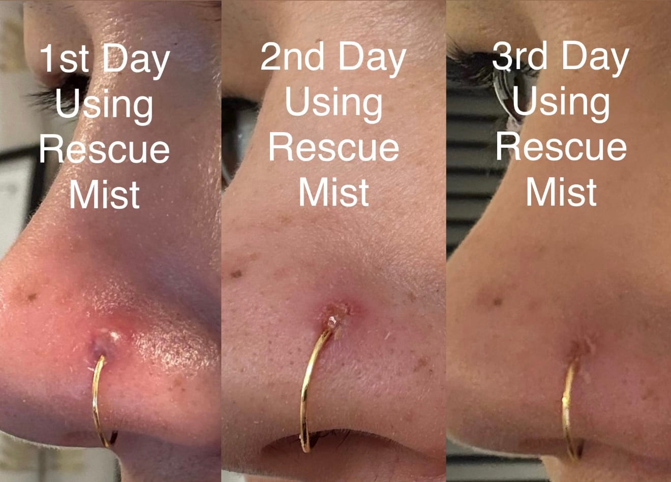 Customer photo review of Rescue Mist 100ml - Bulk Discount