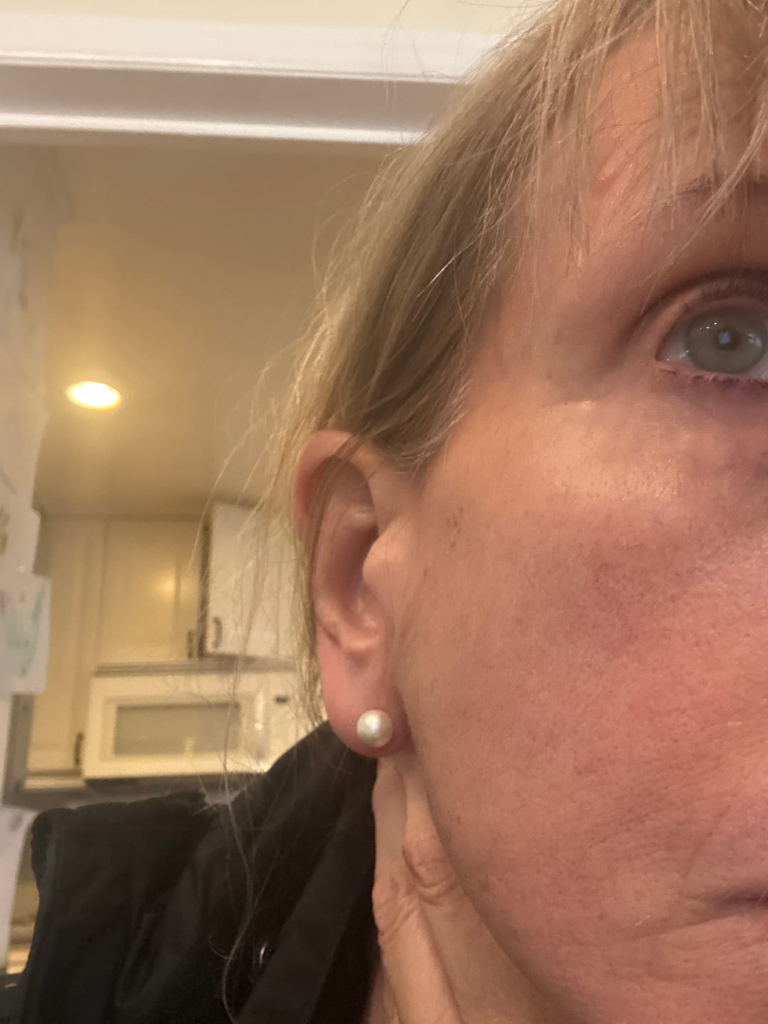 Customer photo review of ACTIVE PRO SERUM | ANTI-AGING