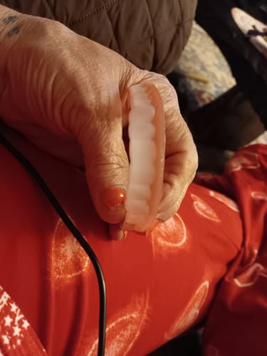 Customer photo review of 🦷  Fit Full Functional DenturesMake you more confident-Made in the USA & FDA-Certified