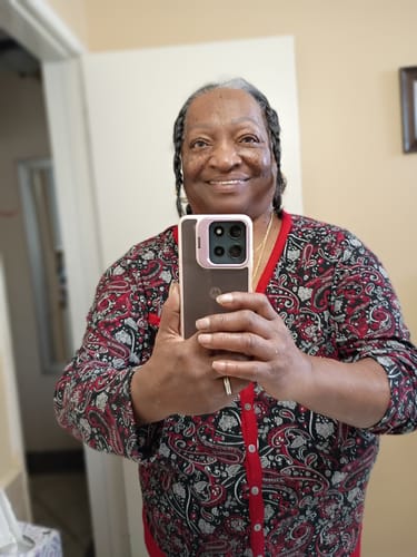 Reviewer smiling, showing her hairline after one week of using the Rennora Hair Growth Serum.