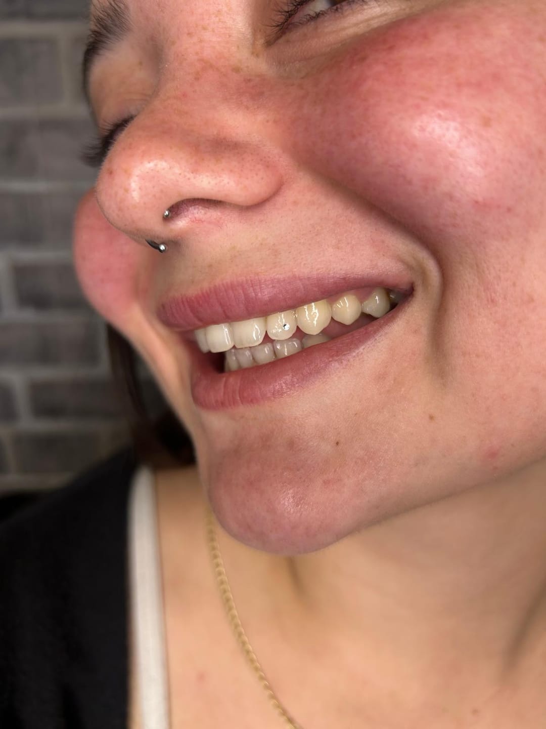 Customer photo review of Formación técnico de joyería dental online - Curso online de gemas dentales
