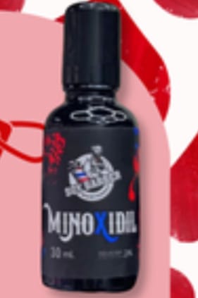 Customer photo review of Soy Barber - Minoxidil 30ml