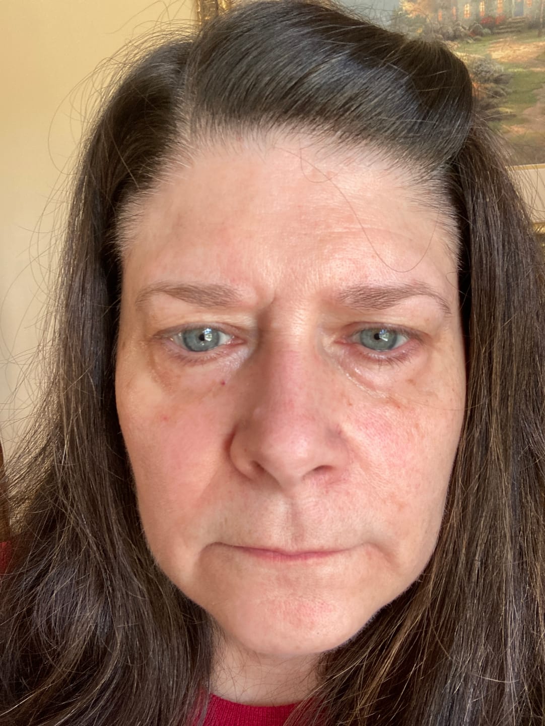Customer photo review of Glov Anti-Aging Serum (5ml)