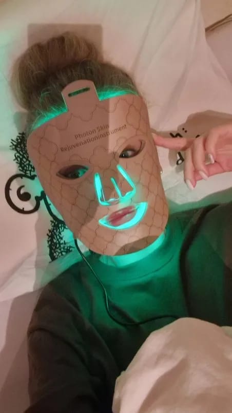 Customer photo review of LUMERA LED Gesichtsmaske