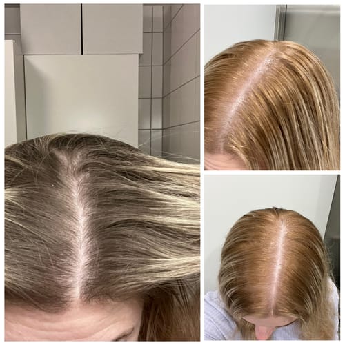 Reviewer's before-and-after images show dark roots turning orange after using the Sunkissed Starter Kit.