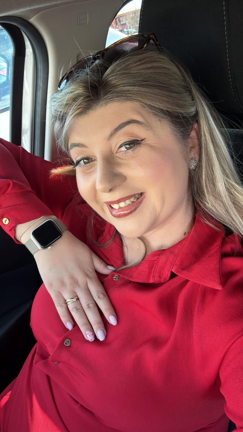 Customer photo review of Curea Ceas Apple Watch Milanese Old Gold   Metalica