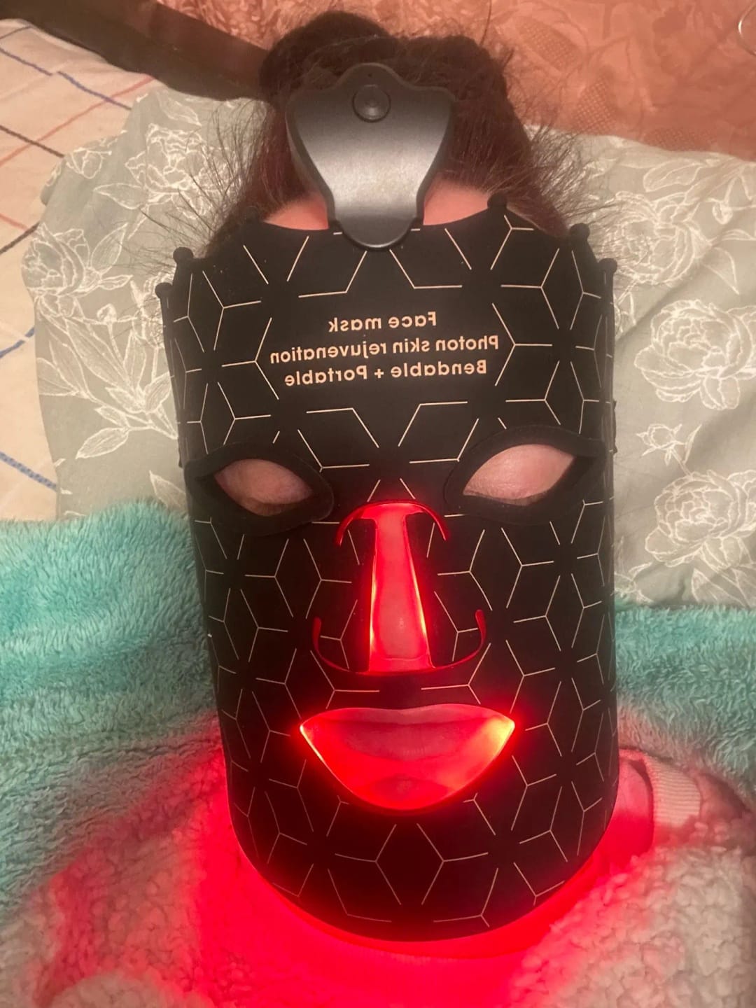 Customer photo review of LUMERA LED Gesichtsmaske