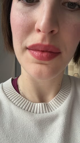 Customer photo review of Lip Over