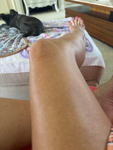 Customer photo review of Besque® Magic Body Oil XL - 200ml