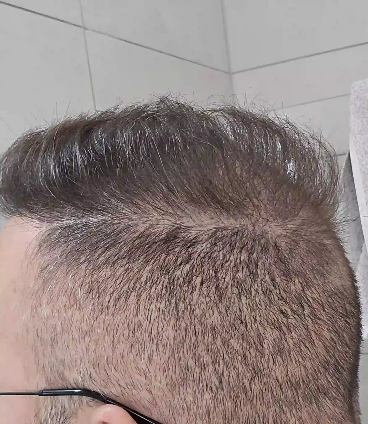 Customer photo review of PRO KIT