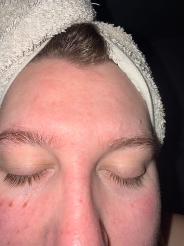 Customer photo review of Seb Natural Calming Serum