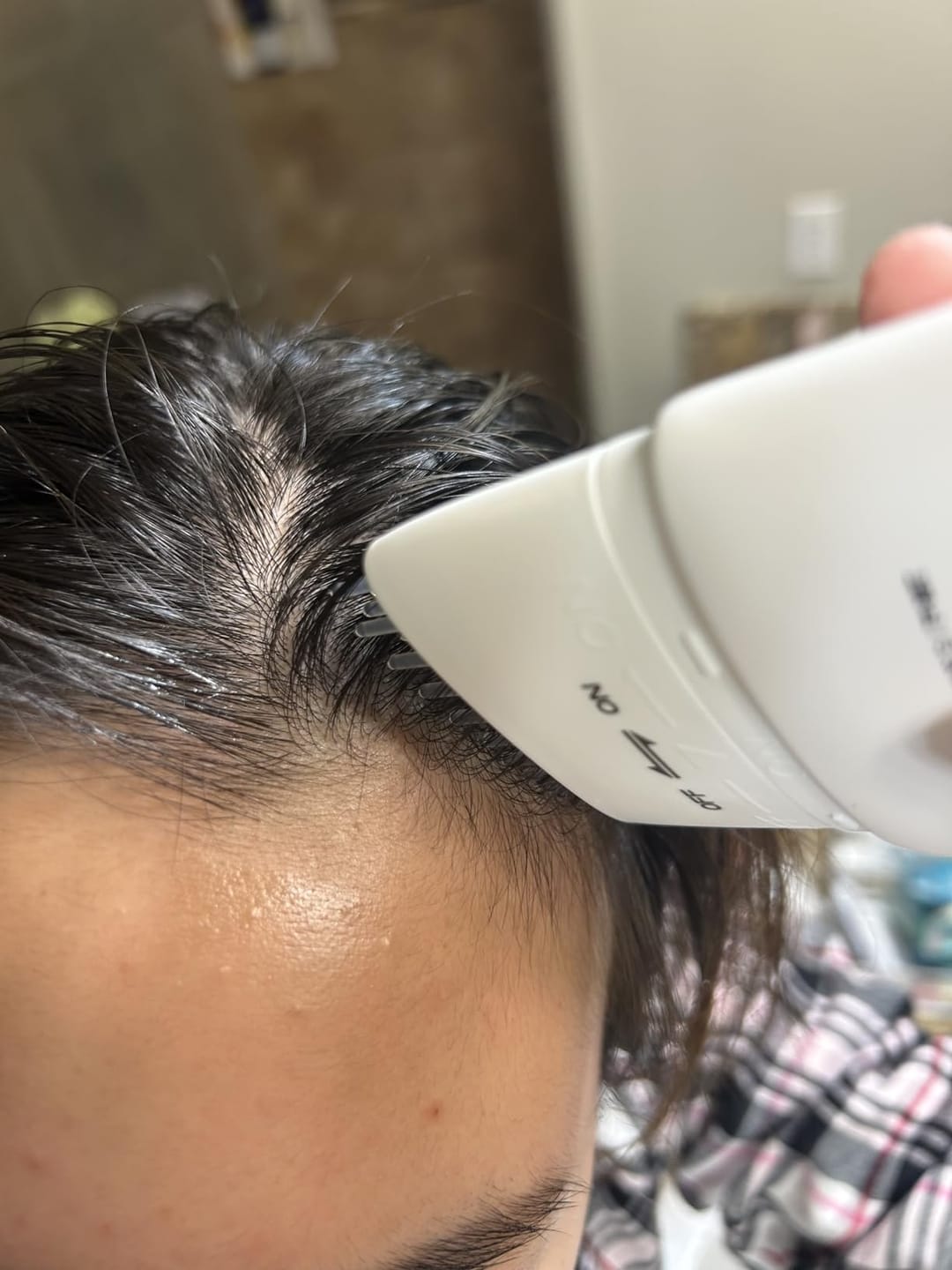 Customer photo review of Velura™ Crown Revival Serum