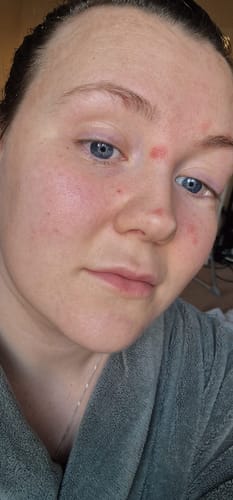 Customer photo review of Seb Natural Soothing Balm