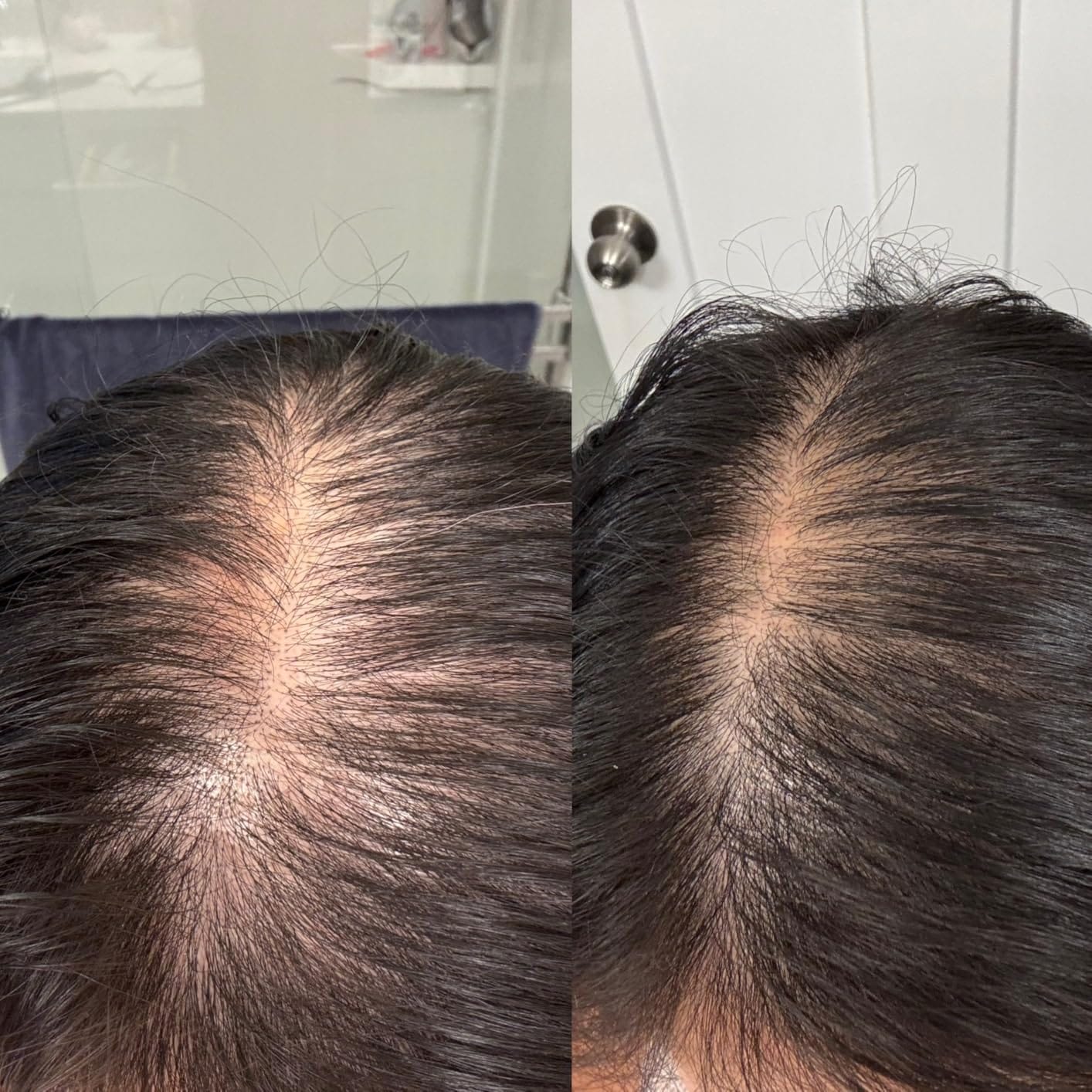 Customer photo review of Velura™ Crown Revival Serum