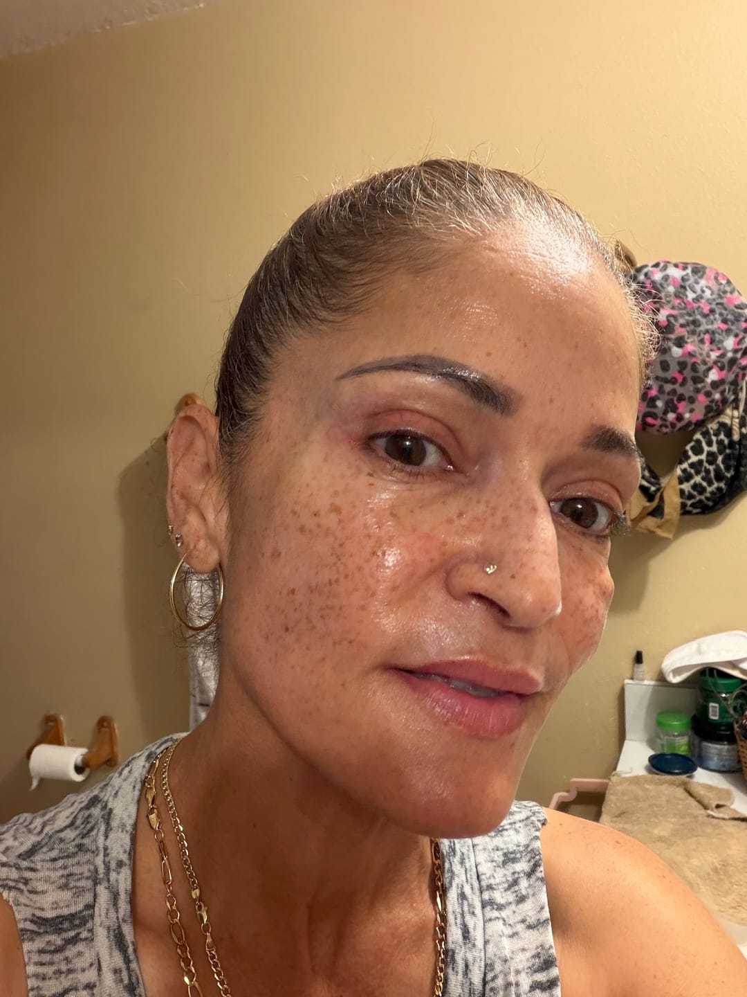 Customer photo review of INIA PDRN Intensive Repair Duo