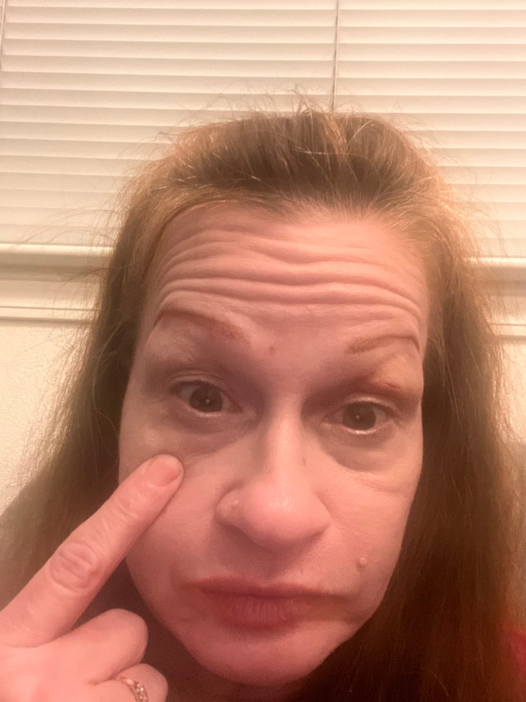 Customer photo review of Glov Micro Infusion System