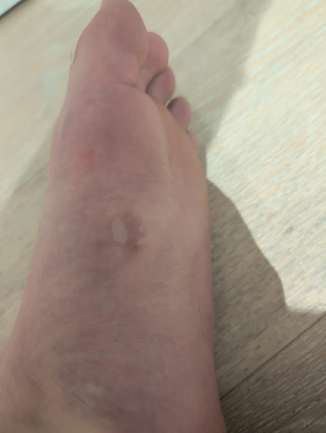 Customer photo review of Running insoles