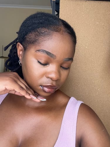 Customer photo review of Minoxidil 5% SOLUTION, 3x60ml pack