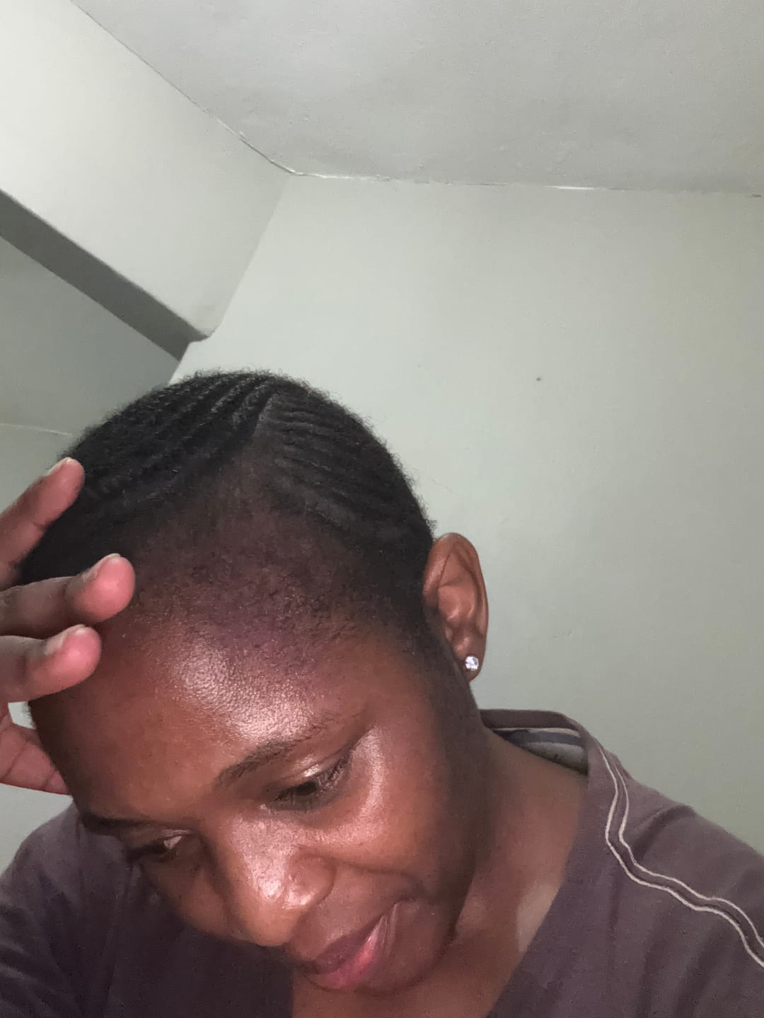 Customer photo review of Derma Roller 0.5mm