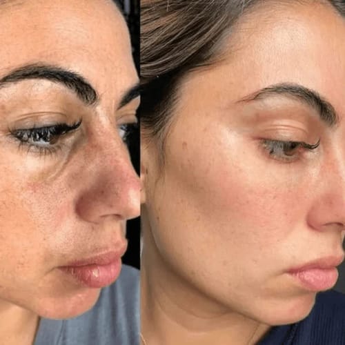 Customer photo review of Duo Peel Shot DIVAYA