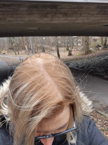 Reviewer shows their hair with warm, orange roots after using the Sunkissed Starter Kit.