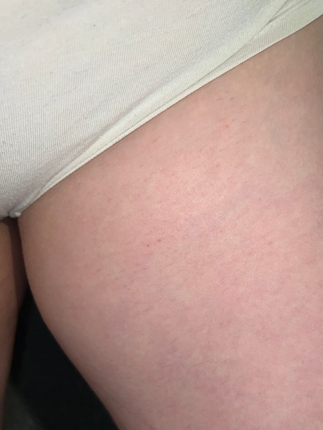 Customer photo review of Superfood Intimate Care Kit
