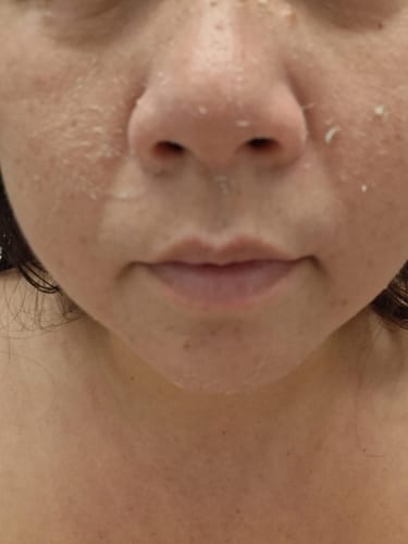 Customer photo review of Duo Peel Shot DIVAYA