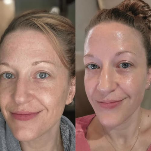 Customer photo review of Duo Peel Shot DIVAYA