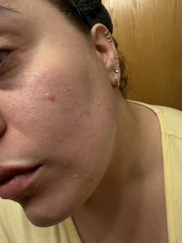 Customer photo review of Duo Peel Shot DIVAYA