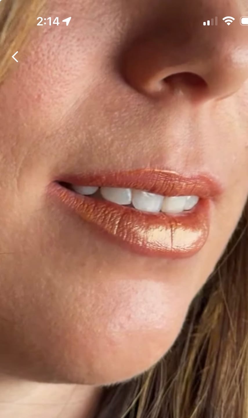 Customer photo review of Radiant Rose Gold Lip Gloss