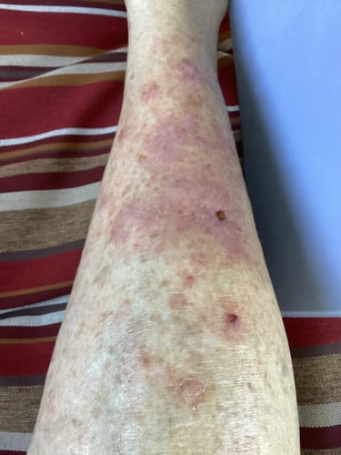 Customer photo review of TryTallow™ Grass-Fed Tallow Balm (4oz)