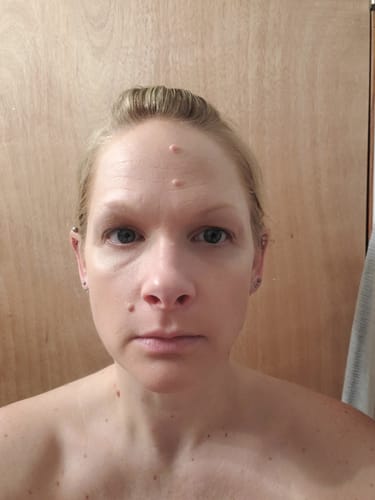 Customer photo review of Transform Wrinkles, Fine Lines, And Tired Creases Naturally