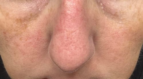 Customer photo review of Duo Peel Shot DIVAYA