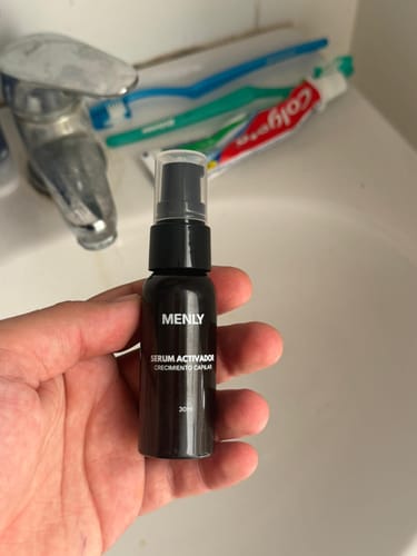 Customer photo review of Protocolo contra la alopecia. Sin Minoxidil. Sin Finasterida. Sin efectos secundarios