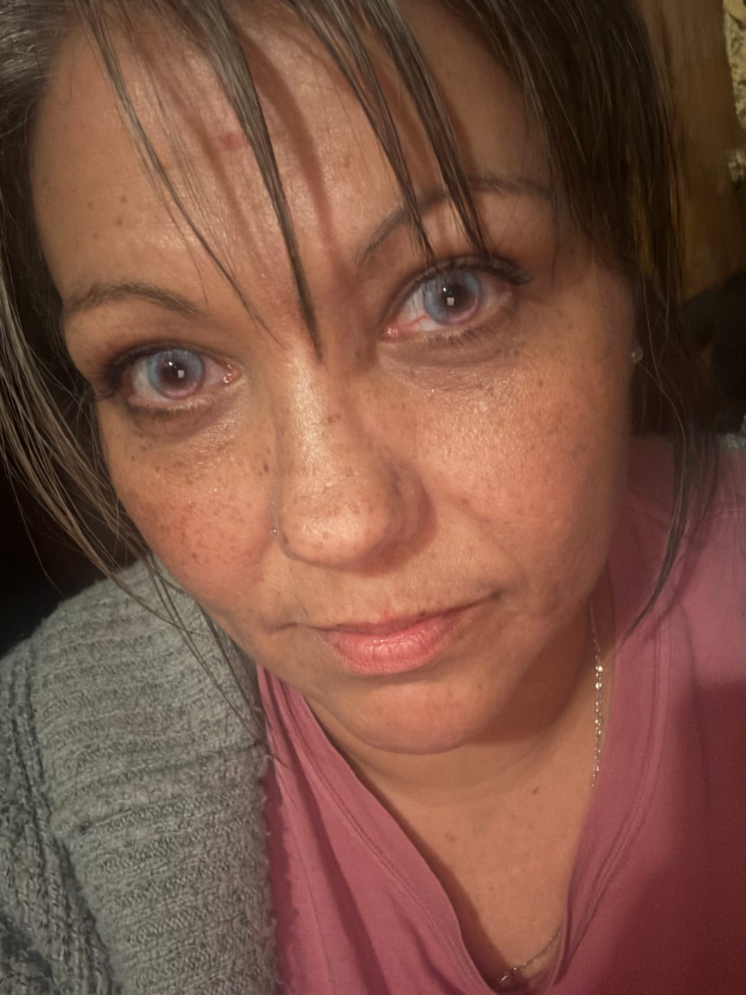 Customer photo review of Halloween White out Colored Contact Lenses