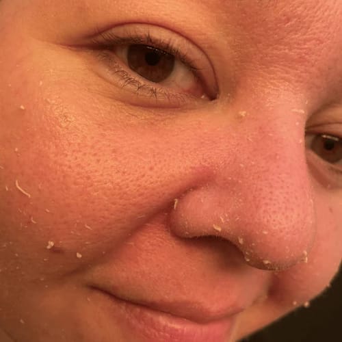 Customer photo review of Duo Peel Shot DIVAYA