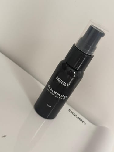 Customer photo review of Protocolo contra la alopecia. Sin Minoxidil. Sin Finasterida. Sin efectos secundarios