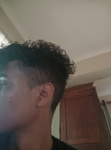 Customer photo review of Minoxidil 5% FOAM, 3x60ml pack