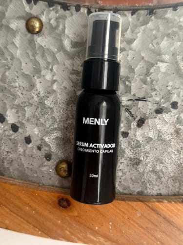 Customer photo review of Protocolo contra la alopecia. Sin Minoxidil. Sin Finasterida. Sin efectos secundarios