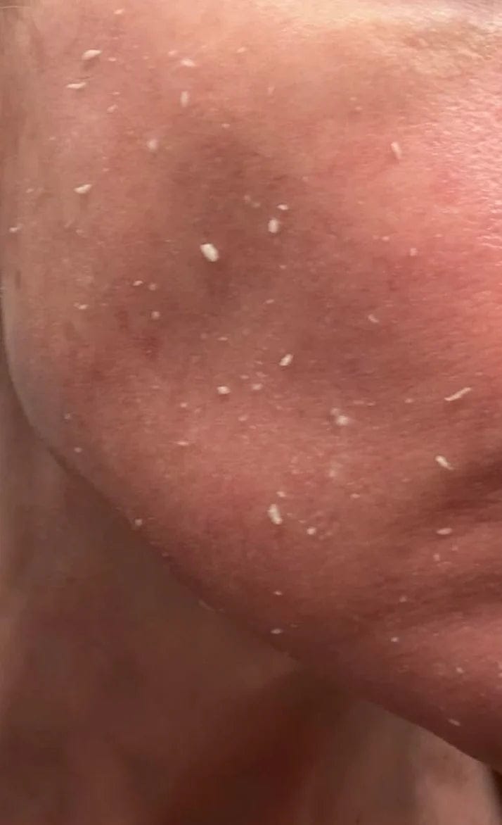 Customer photo review of Duo Peel Shot DIVAYA