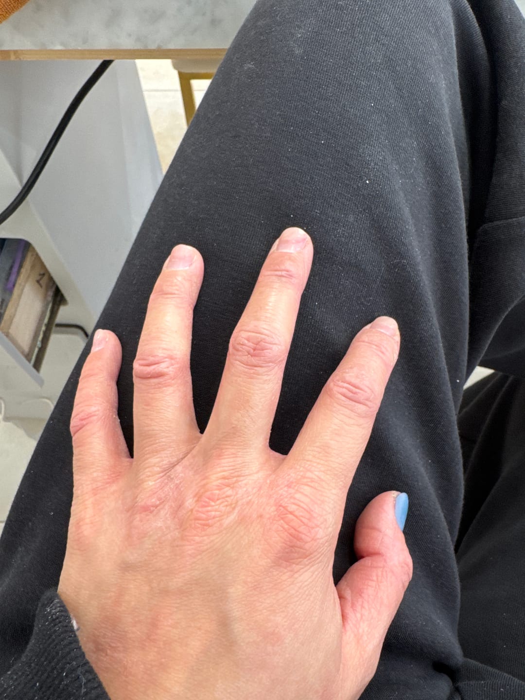 Customer photo review of Multi Strain Biotic