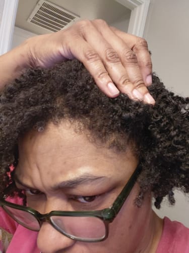 Customer photo review of Hair Growth Bundle