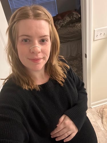 Customer photo review of Second Wind Nasal Strips