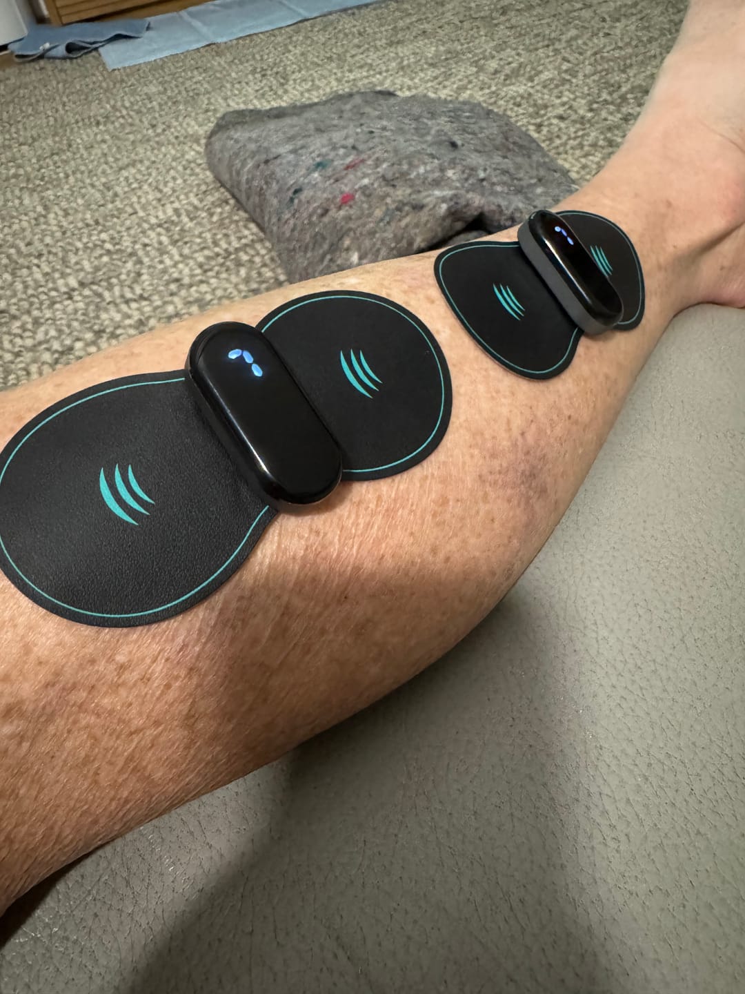 Customer photo review of Vibit TENS - Electrical Nerve Stimulation Therapy