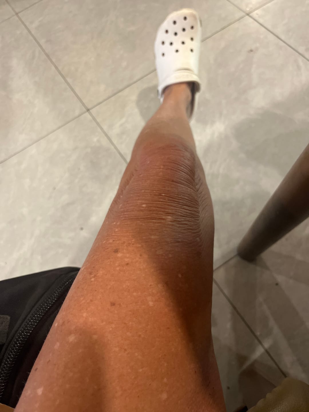 Customer photo review of Self Tanning | 150 Capsules